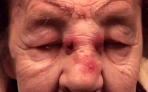 mulch centers place neighbors at risk of cancer by releasing wood dust into the air