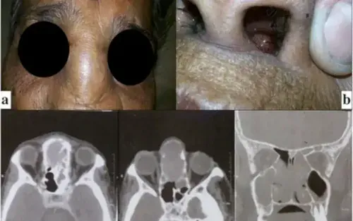 Wood Dust Being Released into the neighborhoods